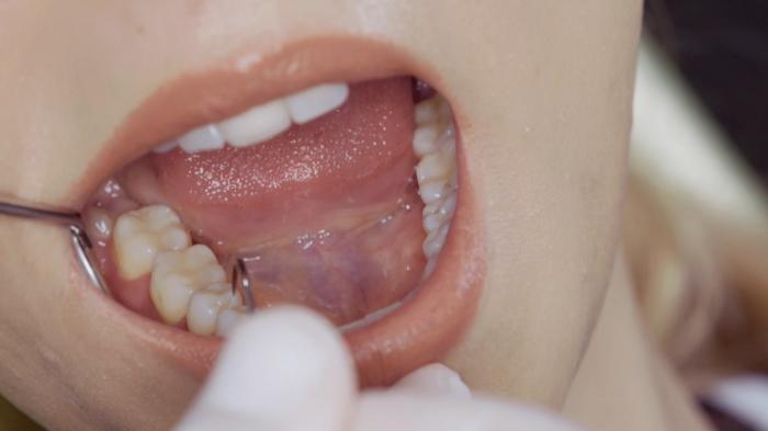 STG 8/9 year wait for an NHS dentist: Why are waiting lists so long?