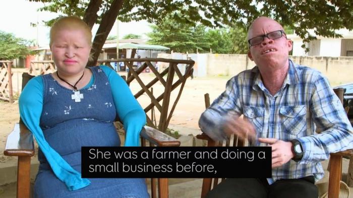 Tanzania - Albino Outreach