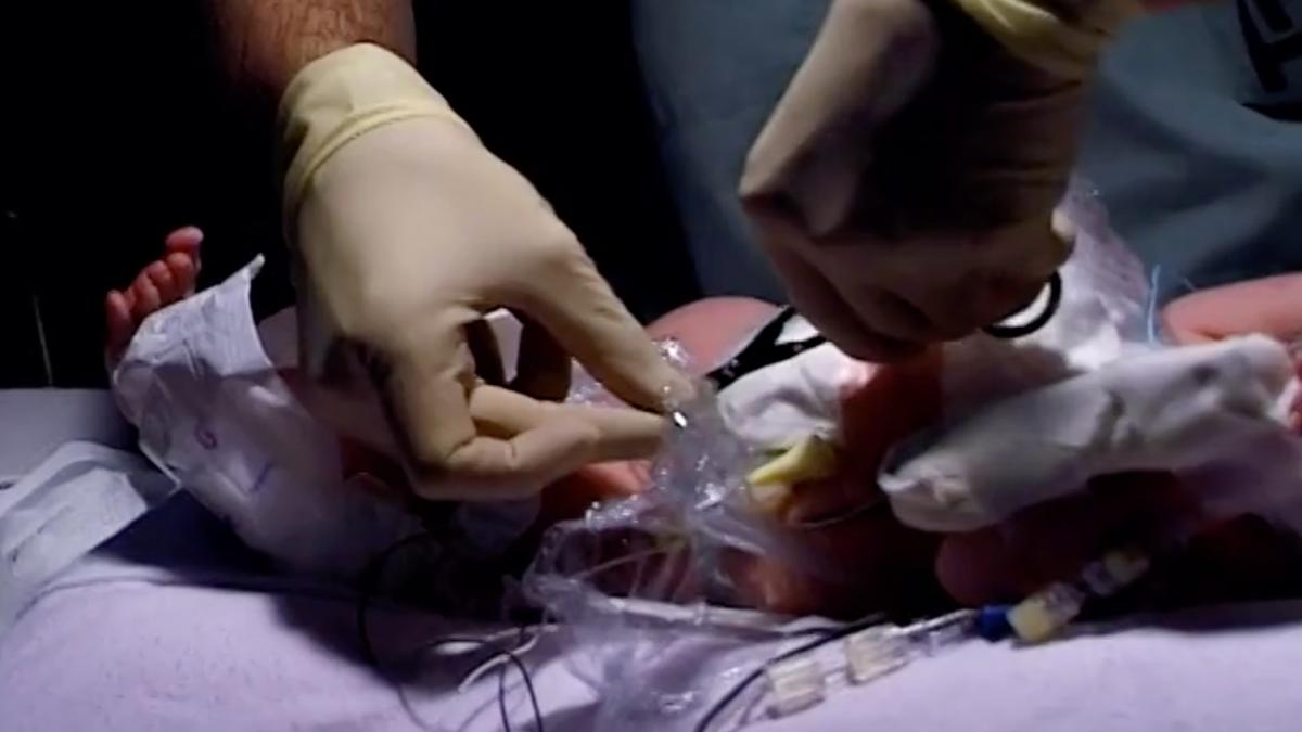 Little Miracles S1EP14